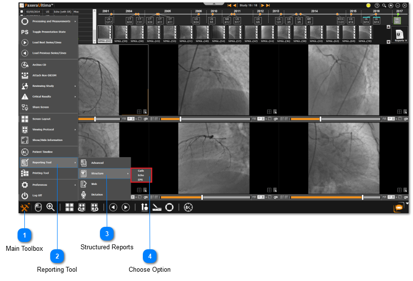 11.1.0. Cardio Structural Reports