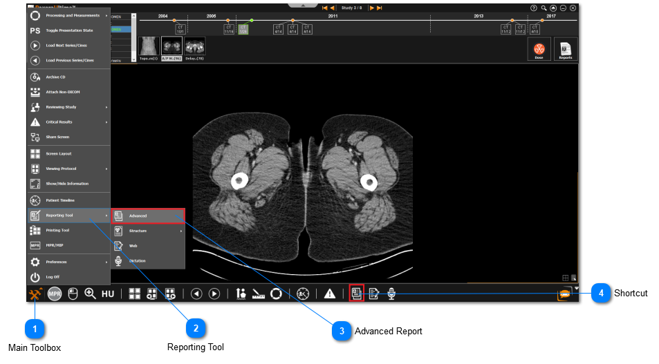 15.3.0. Advanced Report