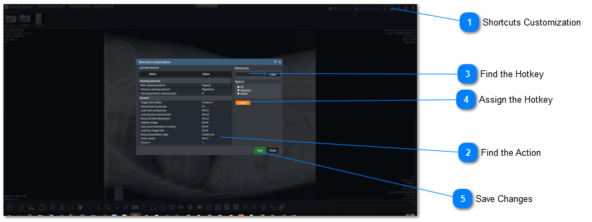 17.2.1.3. Shortcuts customization