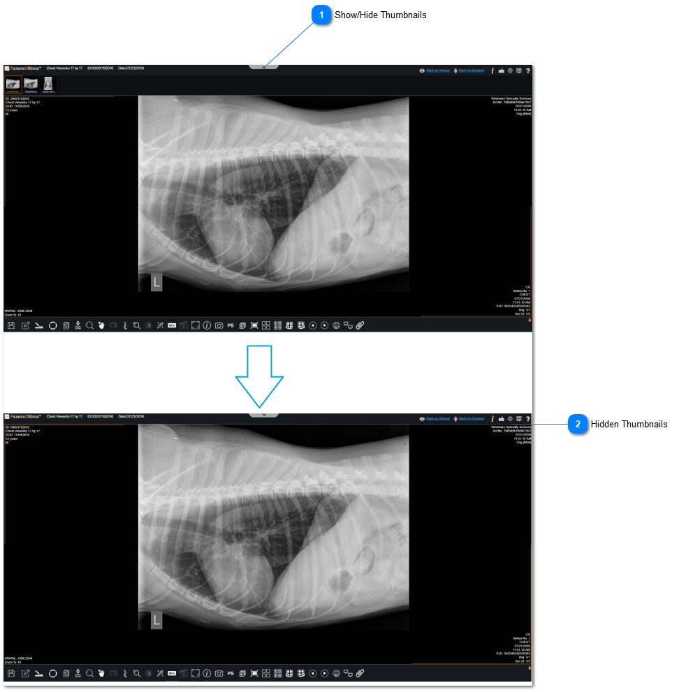 17.2.5.1. Show/Hide Thumbnail