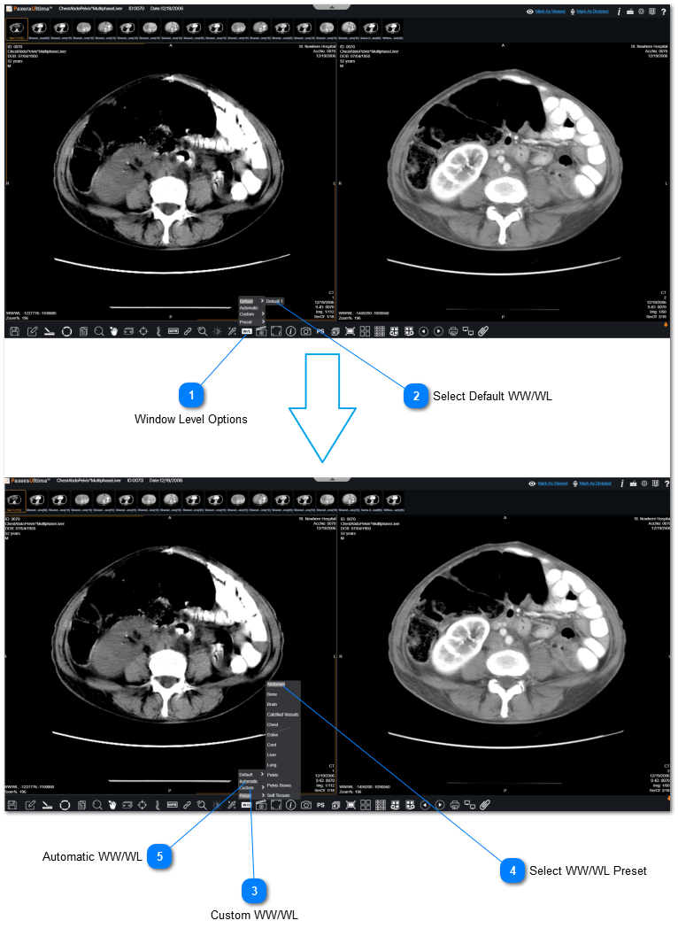 17.2.5.2. Window Level Options