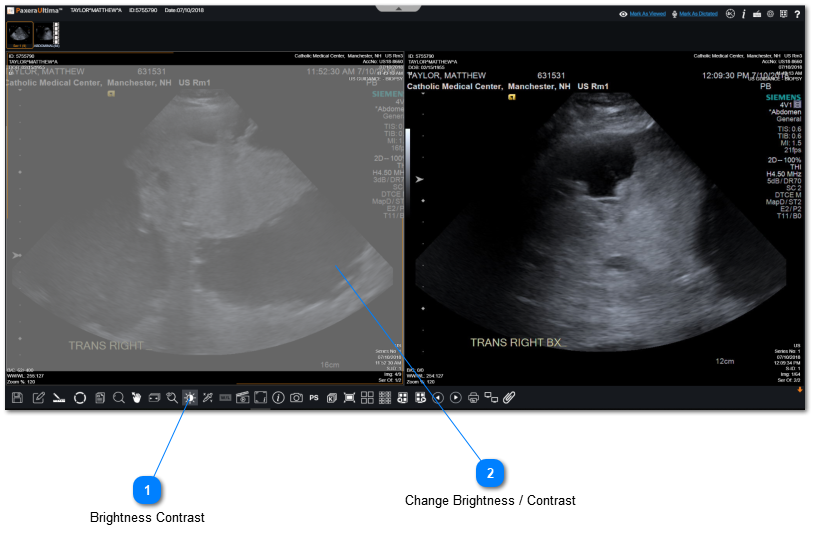 17.2.5.7. Brightness/Contrast