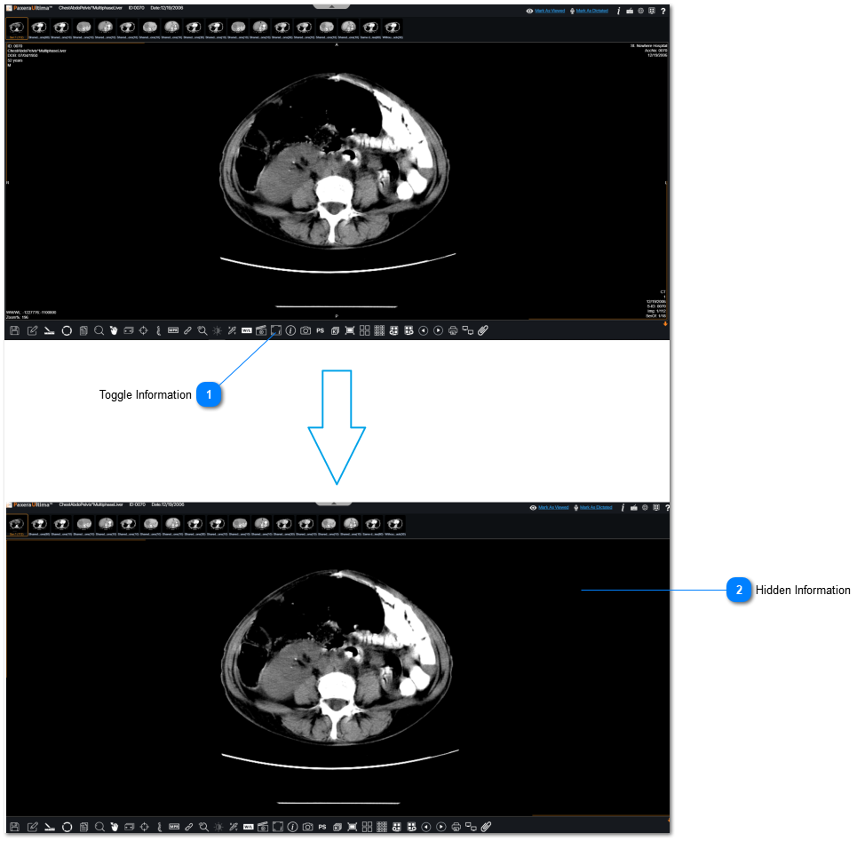 17.2.5.9. Toggle Information