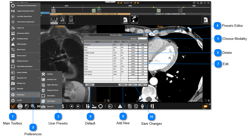 19.5.0. User Presets