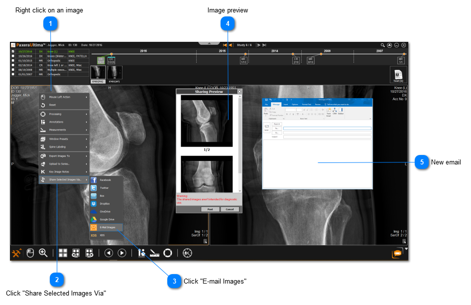 6.5.0. Email Anonymized Images