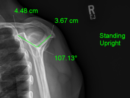 1. Right-click Image