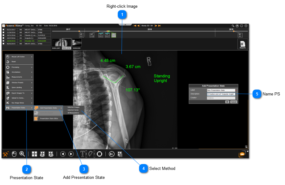 8.6.1. Add Presentation State