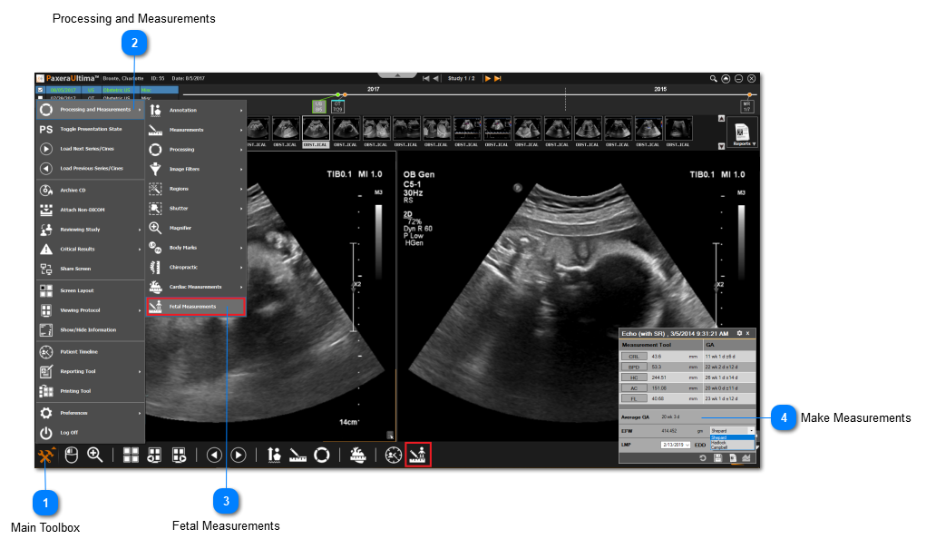 9.2.0. Fetal Measurements