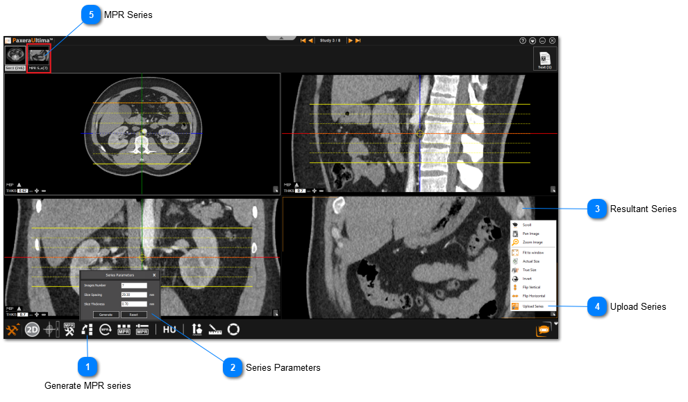 9.4.8. Generate MPR Series